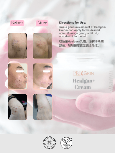 Healgan+ Cream - Image 4